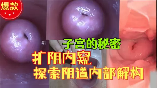 JUL-233 极品人妻医疗调教 扩阴器深挖骚穴内窥全记录